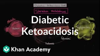 Acute complications of diabetes - Diabetic ketoacidosis | NCLEX-RN | Khan Academy