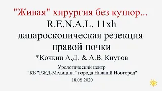 Live lap partial for RENAL 11xh tumor/Живая хирургия/лапароскопическая резекция почки при RENAL 11xh