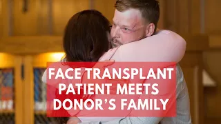 Heartwarming moment face transplant patient meets donor's family