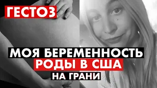 ГЕСТОЗ при беременности! РОДЫ В США.ДАВЛЕНИЕ 190!!