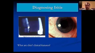 Anterior Segment Disease: What Every Optometrist Should Know (11/30/2021)