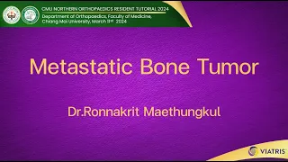 Metastatic Bone Tumor