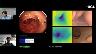 Towards Understanding Surgical Scenes Using Computer Vision - Bay Vision Virtual Meetup - July 7