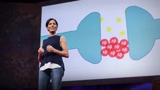 What You Can Do to Prevent Alzheimer's | Lisa Genova | TED