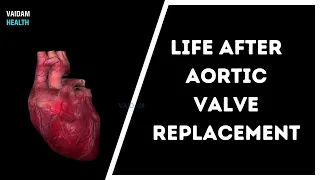 Life After Aortic Valve Replacement