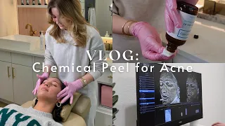 VLOG: I Got a Chemical Peel for My Acne! | Sloan Byrd