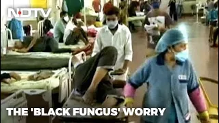 Covid-19 News: As Cases Rise, Karnataka Formulates Steps To Tackle Black Fungus