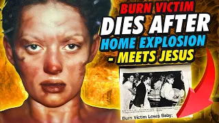 Burn Victim Dies After Home Explosion - Meets Jesus