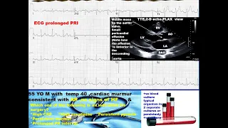 Test your skill ECG Echo Case study 1