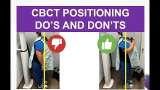 CBCT Positioning