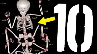 10 części ciała, o których nie miałeś pojęcia [TOPOWA DYCHA]