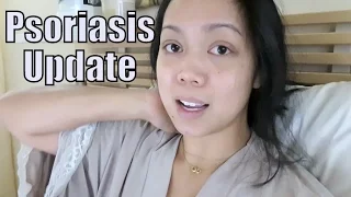 Psoriasis Update - February 19, 2016 -  ItsJudysLife Vlogs