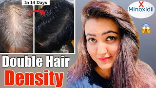 14 Days Challenge : Try This Hair Growth Remedy To Get Double Hair Density & Thick, Long Hair❤️