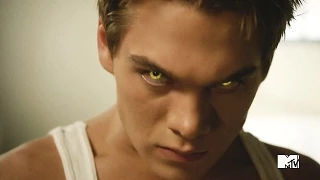 ► Liam Dunbar || Teen Wolf || This is freaking Awesome