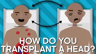 How Do You Transplant A Human Head? | Earth Science