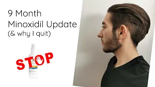 Minoxidil Beard Growth - 9 Month Update (and why I quit)