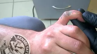 лазерное удаление татуировки Днепр