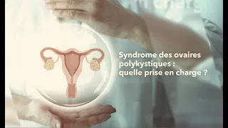 Syndrome des ovaires polykystiques : quelle prise en charge ?