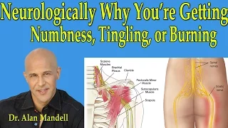 Neurologically Why You're Getting Numbness,Tingling, or Burning in Arms or Legs - Dr Mandell