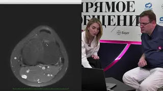 Болезнь жировых тел коленного сустава и хондроматоз.