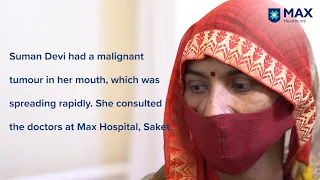 Tumour Removal: Success Story | Patient Recuperates from Late-Stage Malignant Tumour | Max Saket