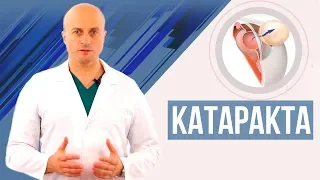 Катаракта - подробное видео с 3D анимацией. Возможно ли лечение катаракты без операции?