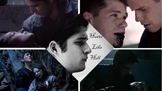 Teen Wolf | The Pack | Hurts Like Hell