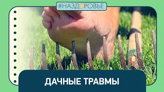 #НАЗДОРОВЬЕ: дачные травмы