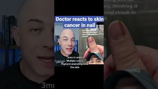 Doctor reacts to skin cancer in nail!