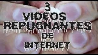 3 VIDEOS REPUGNANTES