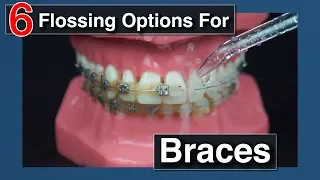 How to Floss with Braces