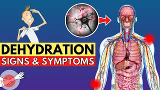 Top 8 Signs of Dehydration (signs you're not drinking enough water) | Dehydration Symptoms