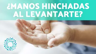 Manos HINCHADAS manos al DESPERTAR (8 Motivos) ✋ (Por qué se me Hinchan las Manos cuando Duermo)