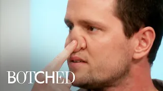 5 ALARMING Botched Nose Jobs | E!