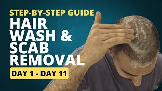 Step-by-Step Guide: How to Wash Your Hair and Remove Scabs after a Hair Transplant (Day 1 to 11)