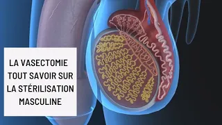 La vasectomie : tout savoir sur la stérilisation masculine