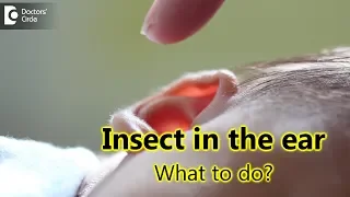 Treatment for insect getting into the ear - Dr. Satish Babu K