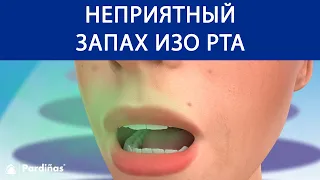 неприятный запах изо рта ©