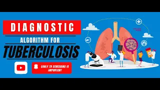 Diagnostic algorithm for Tuberculosis