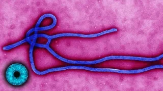 Ebolaausbruch im Kongo gerät außer Kontrolle- Clixoom Science & Fiction