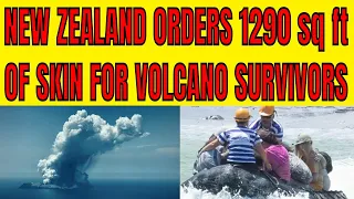 New Zealand Orders 1290 sq ft of Skin For Survivors Of White Island Volcanic Eruption From USA