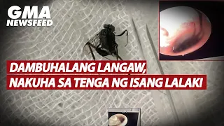 Dambuhalang langaw, nakuha sa tenga ng isang lalaki | GMA News Feed