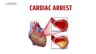 Cardiac arrest is a sudden loss of heart function, breathing, and consciousness | Dr. Abhay Jain