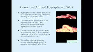 Biochemistry of Congenital Adrenal Hyperplasia - CRASH! Medical Review Series