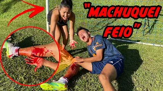 MACHUQUEI FEIO JOGANDO FUTEBOL COM MINHA NAMORADA!! ( deu ruim? )