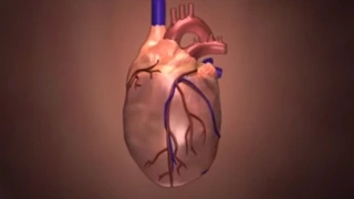 Kawasaki Disease: Animated Heart Video