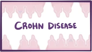 Crohn's disease (Crohn disease) - causes, symptoms & pathology