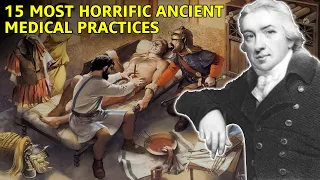 15 Most Horrific Ancient Medical Practices