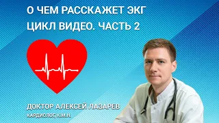 О ЧЕМ РАССКАЖЕТ ЭКГ. ЧАСТЬ 2. РАСШИФРОВКА ЭКГ. РАЗБОР ПРИМЕРОВ ЭКГ #экг  #ДокторАлексейЛазарев