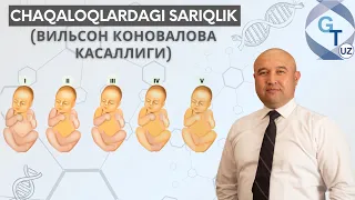 Chaqaloqlardagi sariqlik (Вильсон Коновалова касаллиги)